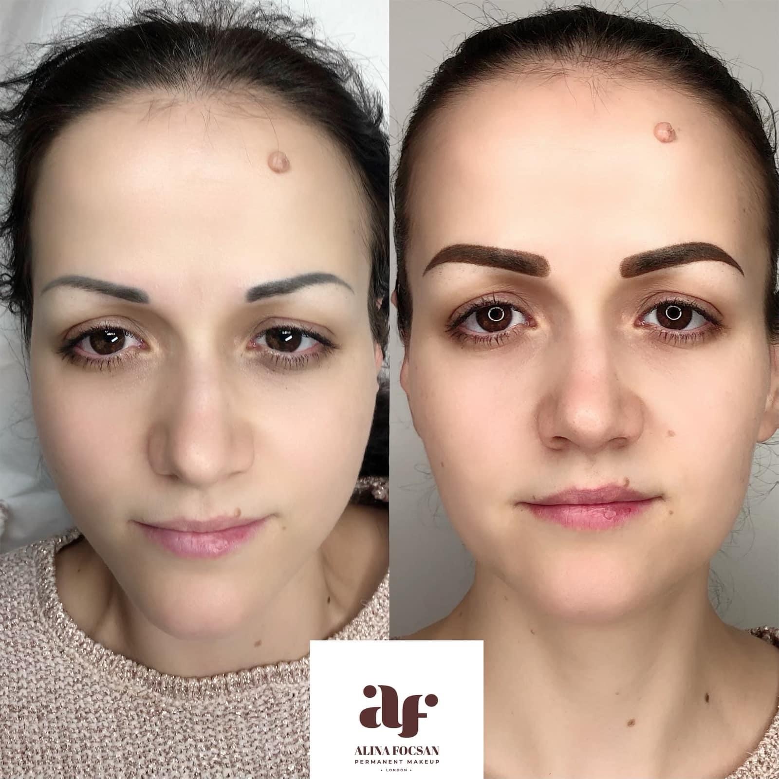 Eyebrow tattoo correction or (neutralization) Eyebrow tattoo correction or (neutralization)