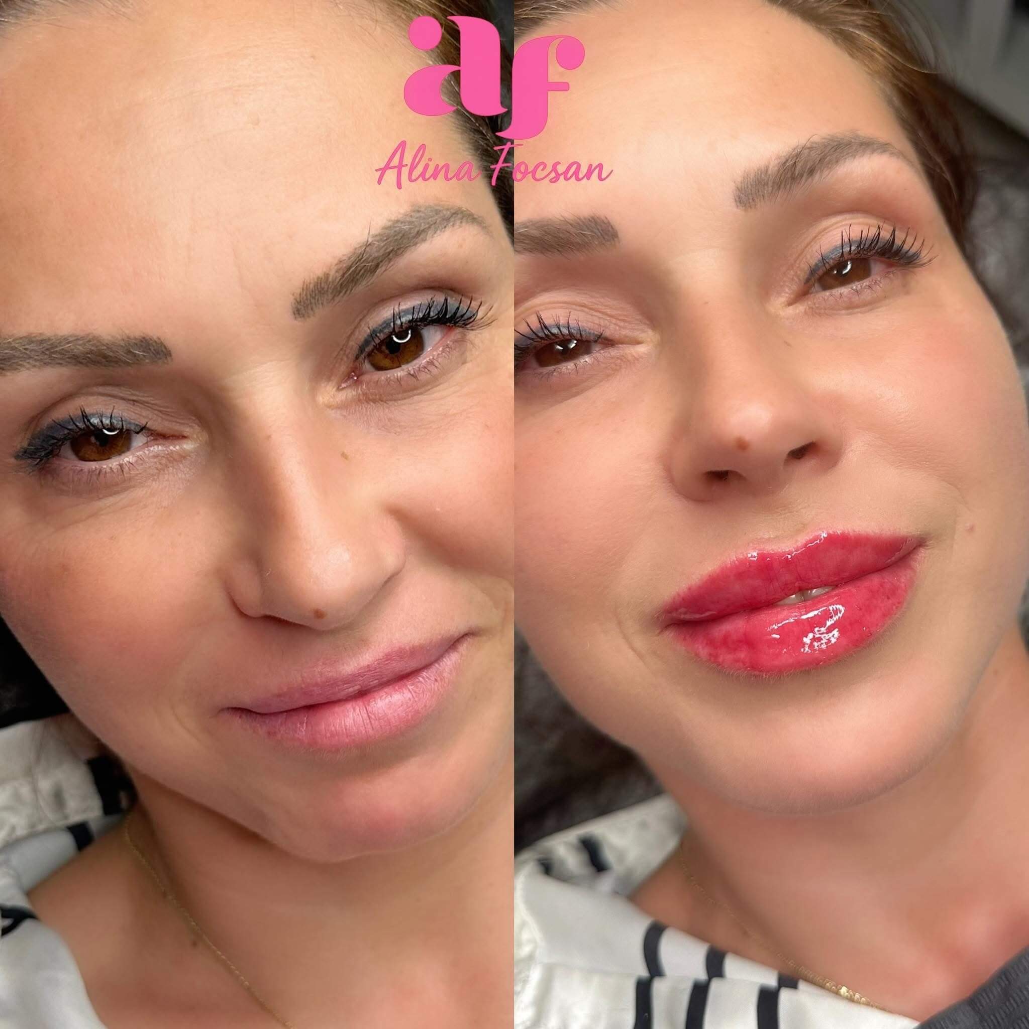 Semi Permanent Makeup - Lip Filler Semi Permanent Makeup - Lip Filler